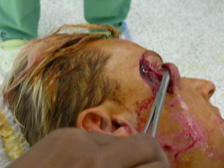 01b Here’s a shot taken surgery, where she needed 51 stitches