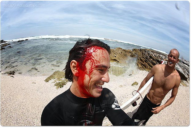 04This fella's grin suggests he still has the endorphins pumping almost as much as the blood