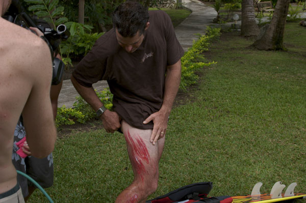 15More lacerations, thanks to the Tahitian body shredder
