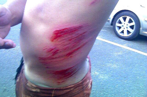 18This mess was caused when the dude strayed off course while surfing at the beautifully monikered Sunset Beach in Hawaii and ended up dashed on the shallows of the rather less idyllically named Boneyards