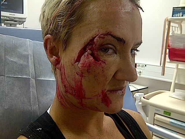 Sh*t! Keala Kennelly got hit pretty hard...