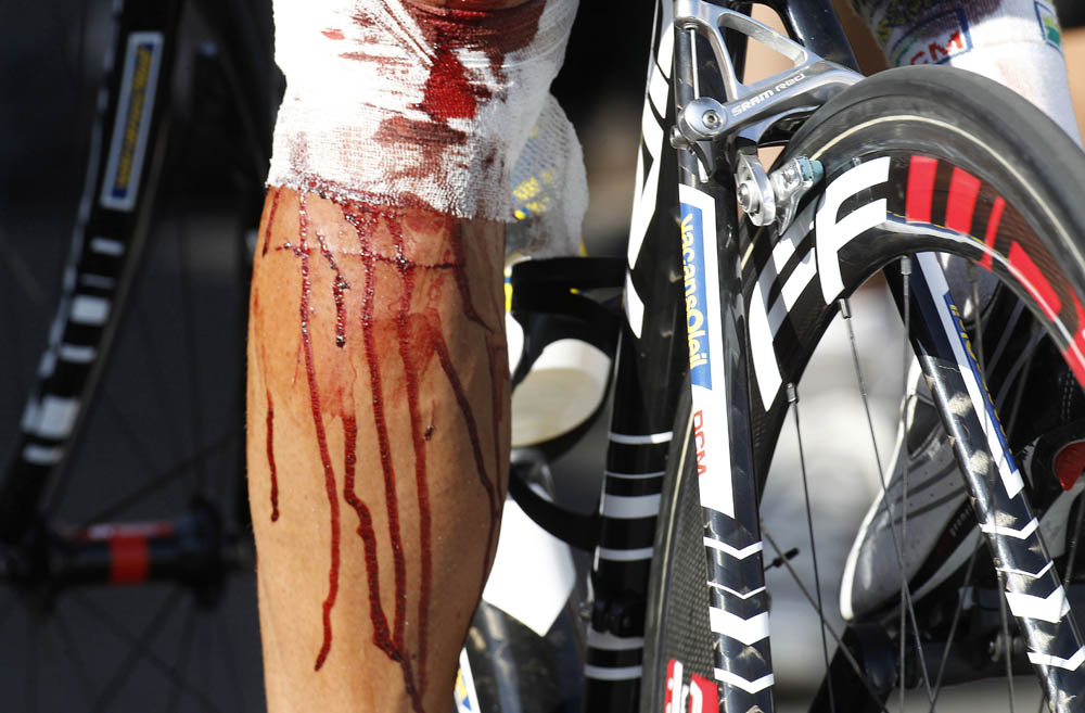 Johnny Hoogerland Tour de France crash barbed wire 2011 car