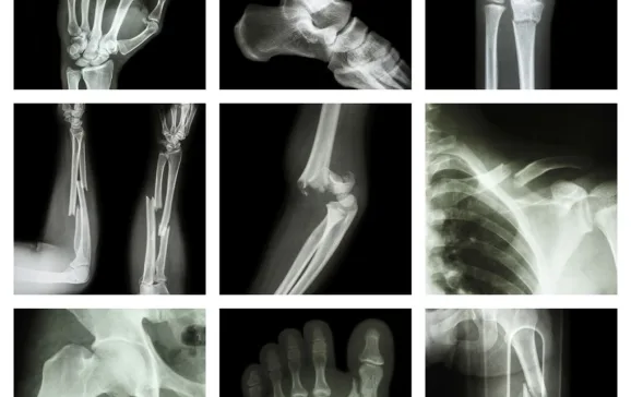 istock 000039026144 medium 1020x1019 1